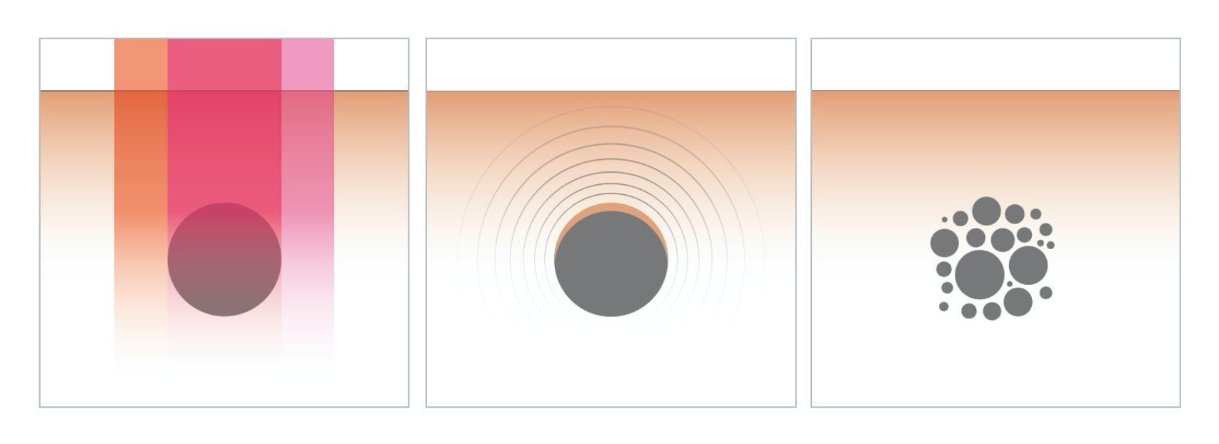 Asclepion NanoStar C для удаления тату ➜ Купить лазер для удаления татуажа в Украине | Alfaspa изображение 16
